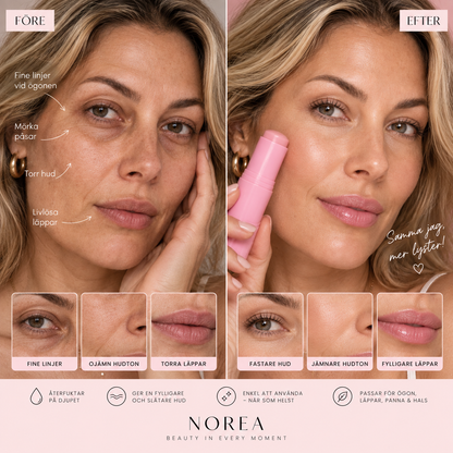NOREA LYSTER -  PDRN Volume Balm